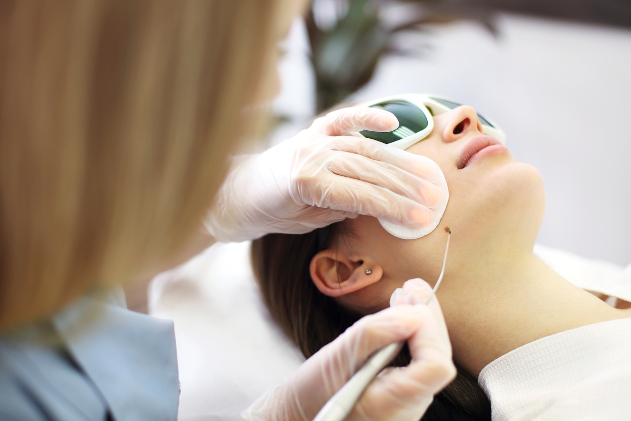 Laser Mole Removal on a Woman's Neck in a Beauty Salon